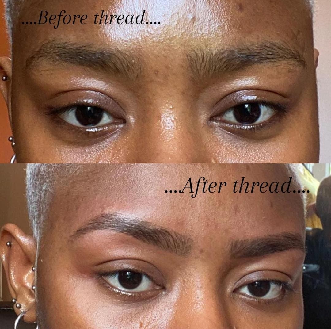 Beauty therapist performing facial treatment